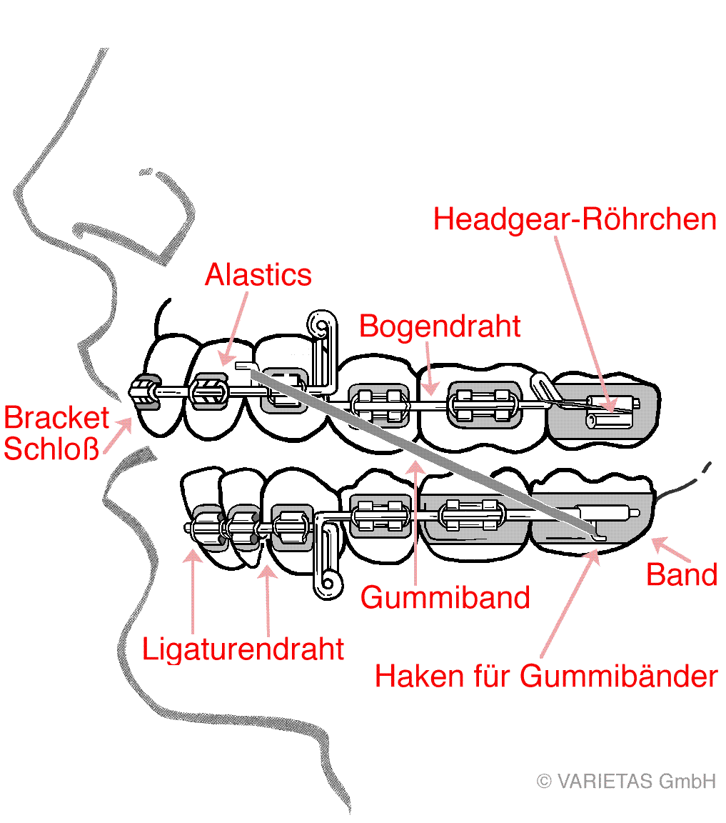 Schema: Multiband-Apparatur